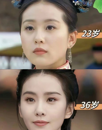 明明五官都比以前更精致了，为什么就是没有年轻时好看​​​
