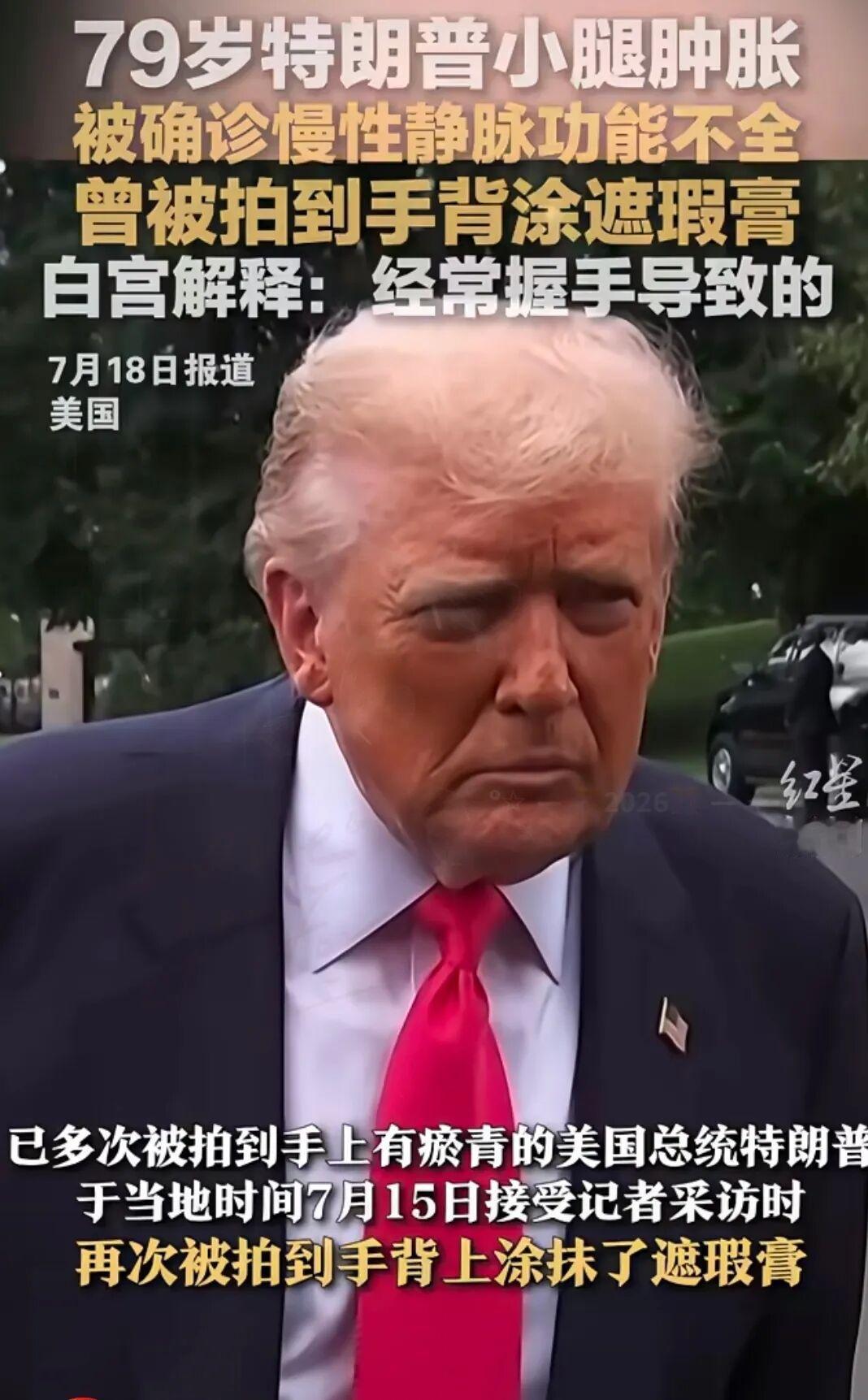 看了那个白宫前医生的爆料，我是真有点怀疑人生。快80岁的老头子，心脏年龄居然