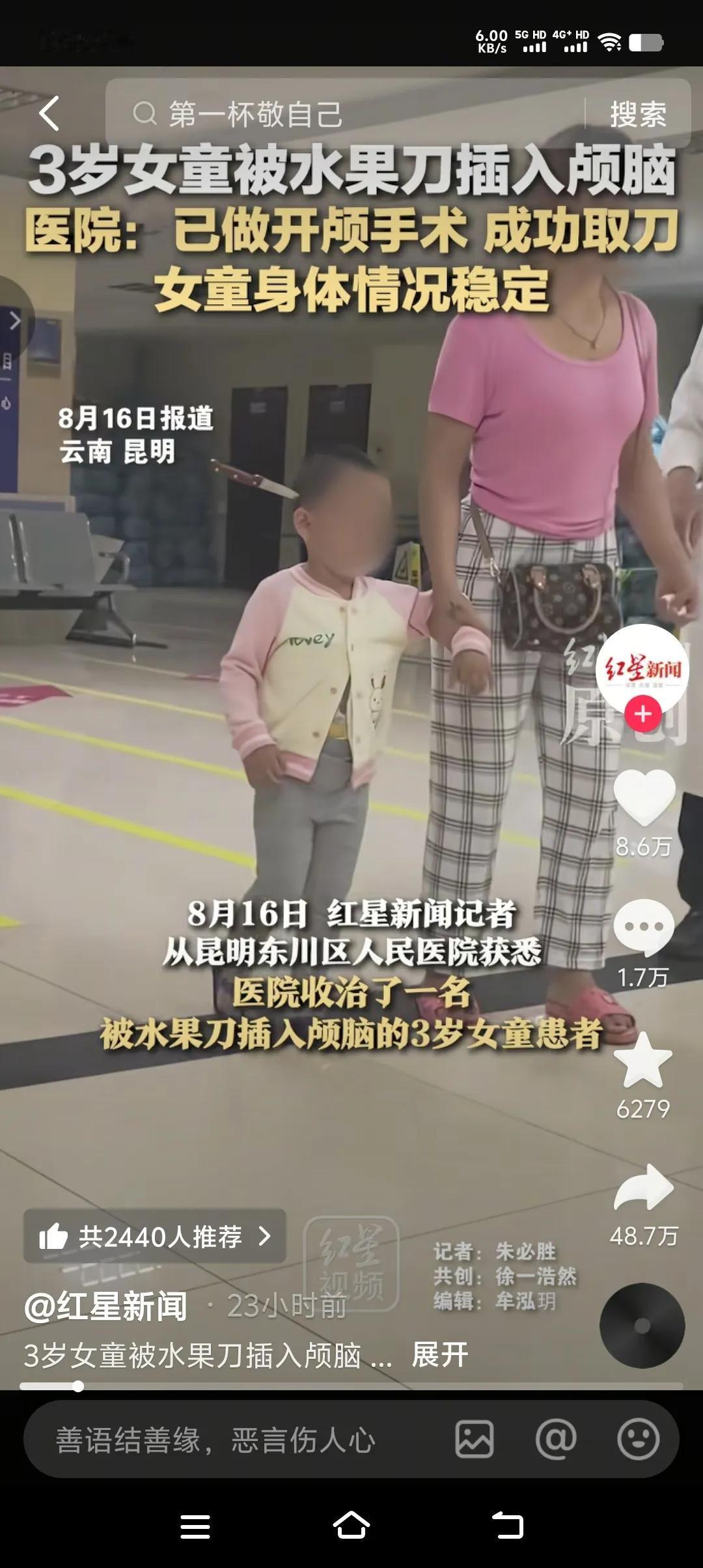 见过淡定的，没见过这么淡定的。三岁女童头上直挺挺的插着一把水果刀，竟然不哭不闹，