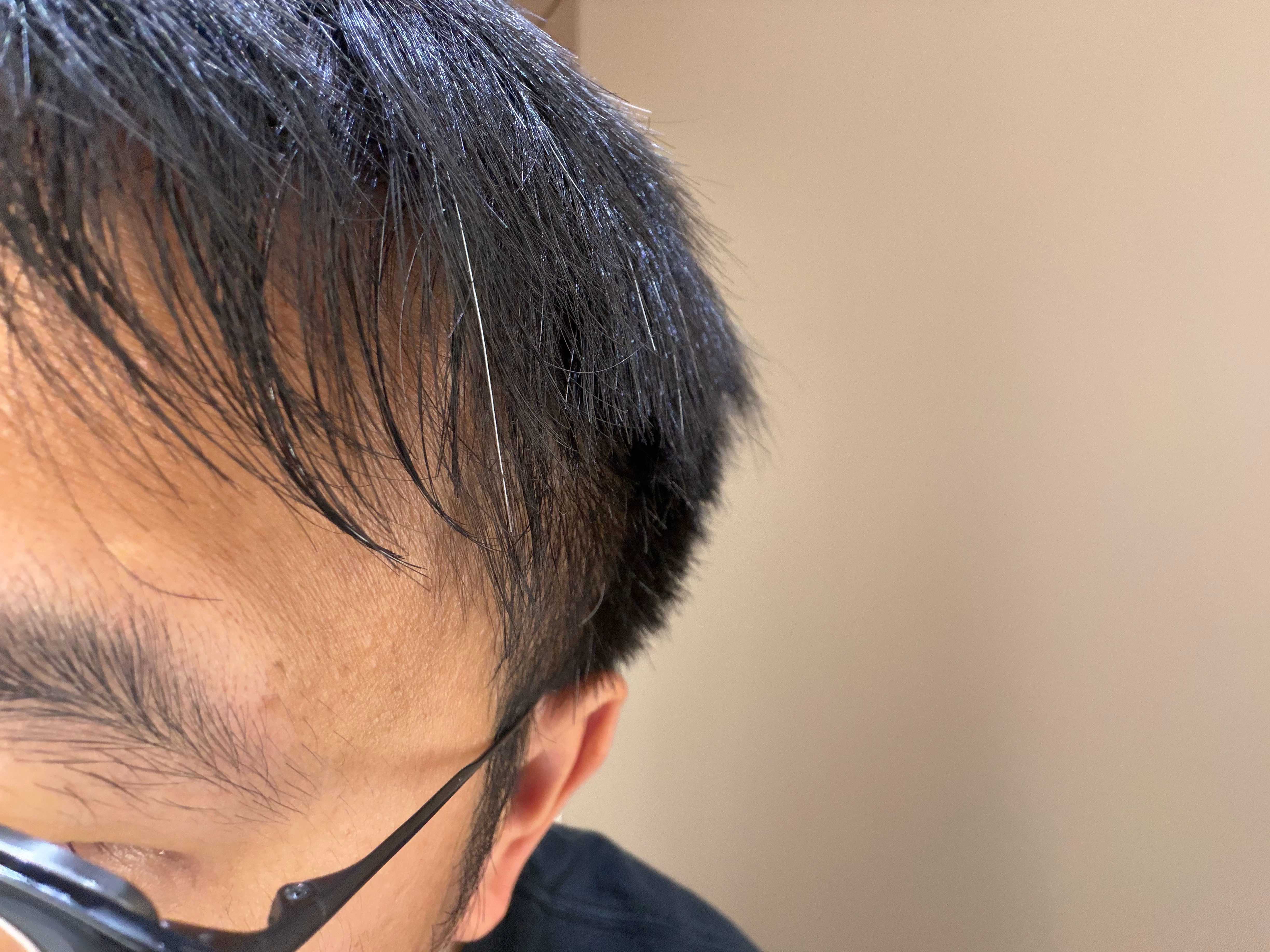非常扎眼的白头发…