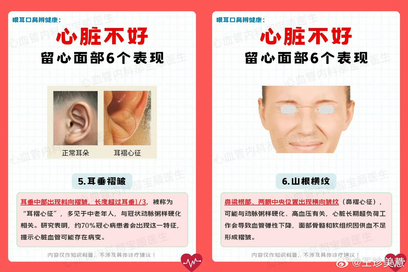 早期心血管病可能反映在脸上脸上有这几个问题建议尽早去医院筛查早期心血管病很有可能