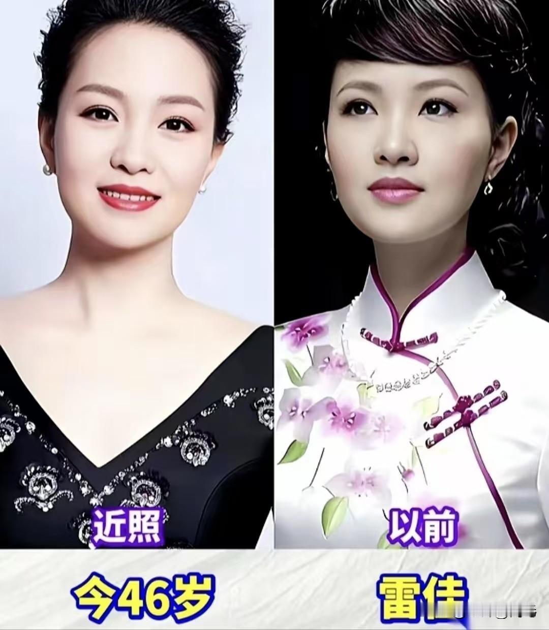 李谷一、宋祖英、于文华、雷佳，她们唱过的那些歌曲，陪伴了几代人的成长。先说雷