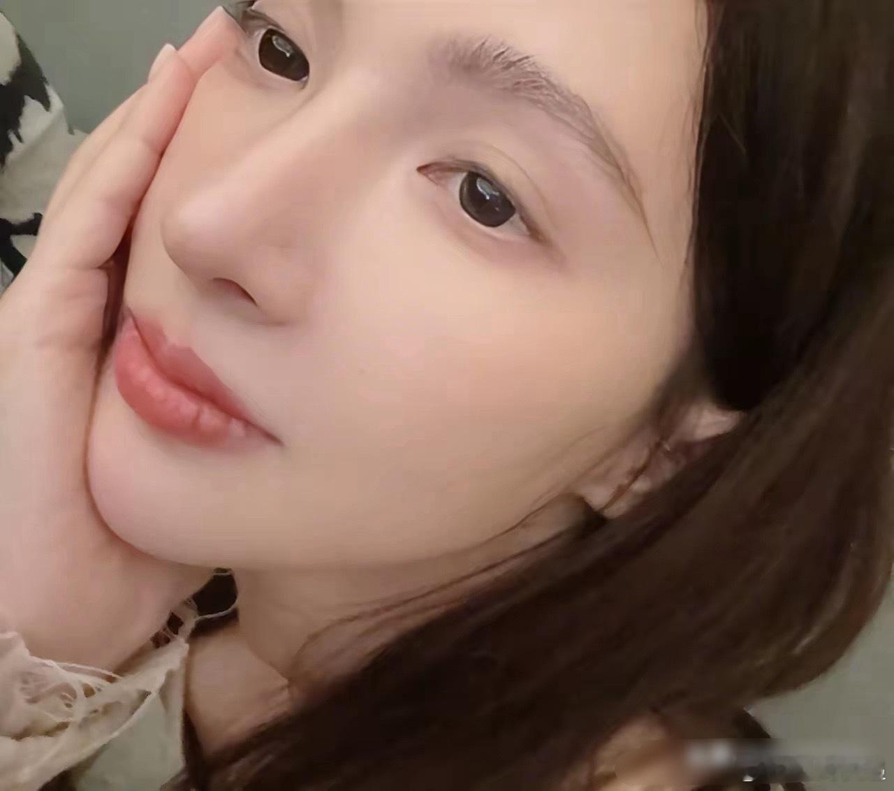 金晨这种小交通事故，根本不存在找人顶包的动机吧？大概率是自己开车受伤了，急着去医