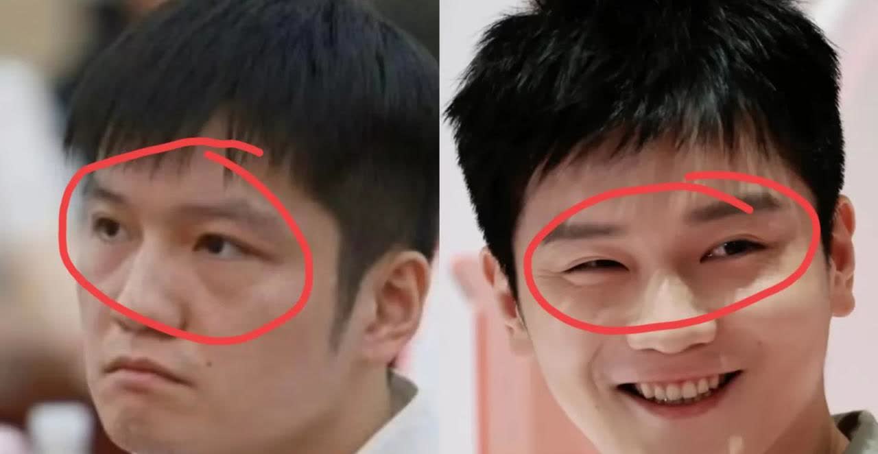 真是绝了，这定律真是谁来了都不好使，樊振东也不例外，原来不上班真的会让眼