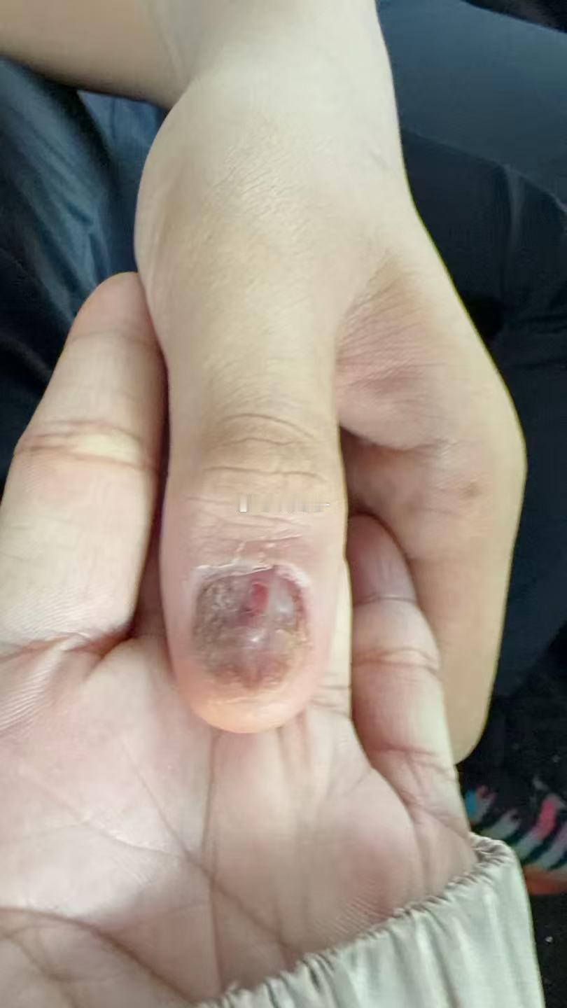 视频转出来之前：不至于这么骂吧？缓冲出来之后：嗯。