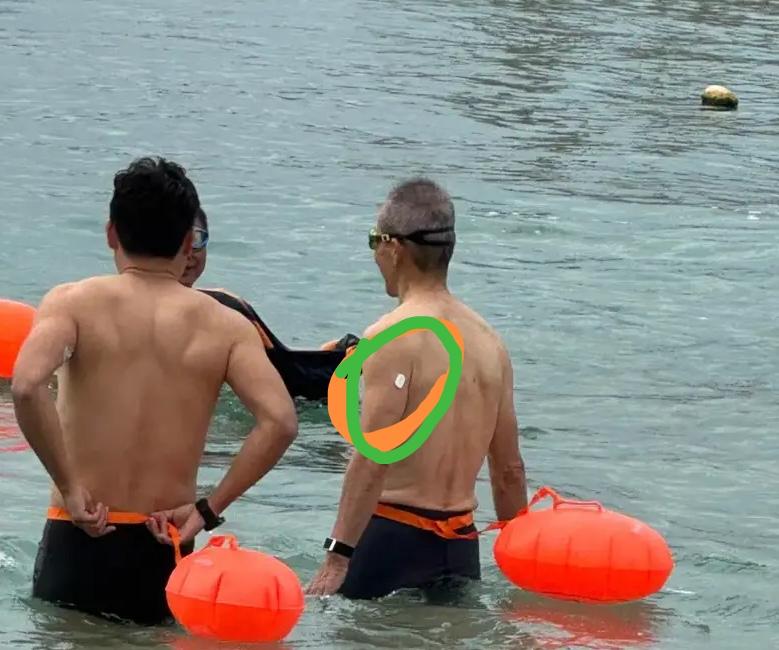 王石低调现身了，就在深圳的大梅沙！但他好像患上了糖尿病，左手大臂的后面，竟然贴上