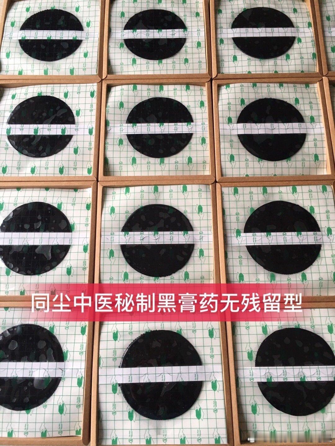 有些颈椎病患者，平时摇晃脖子时咔嚓咔嚓地响，受寒后则颈部僵硬疼痛，好像落枕了，有