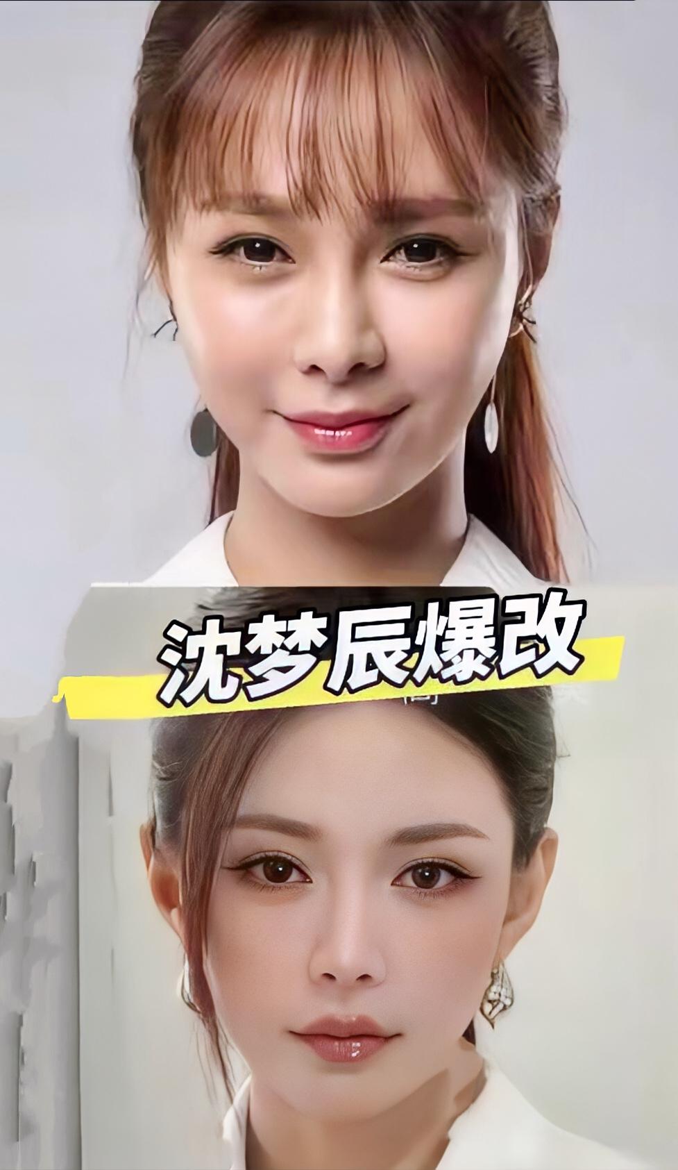 这真是沈梦辰吗又一个整到不认识了娱乐