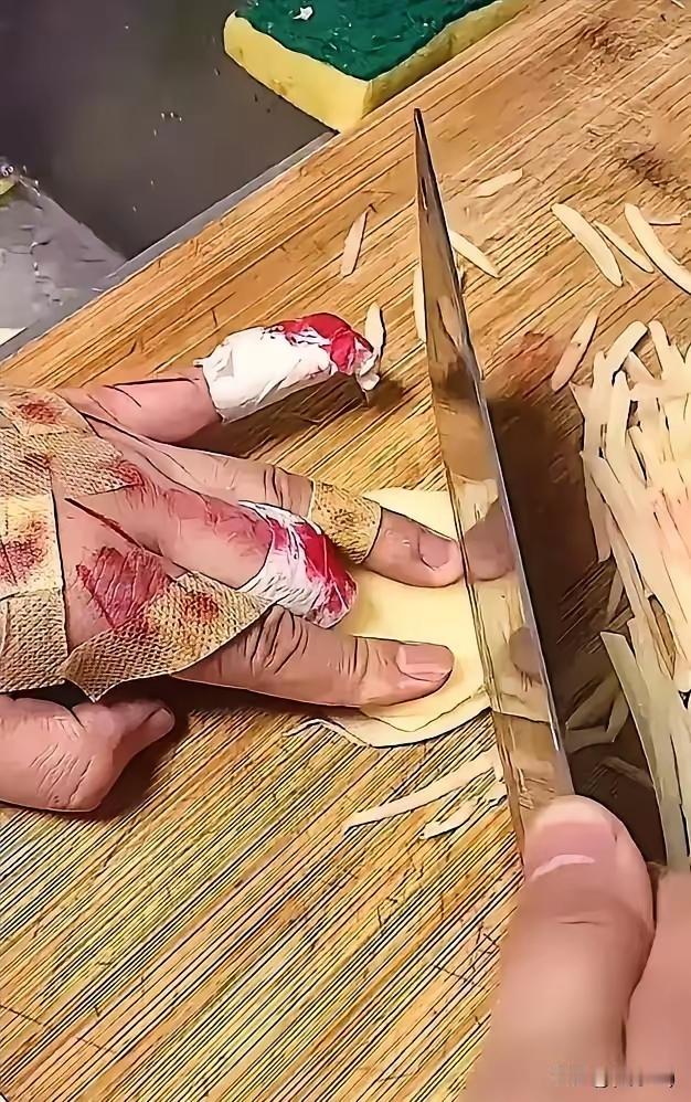 怎么这么不小心，你看，都切到土豆了[捂脸哭][捂脸哭]