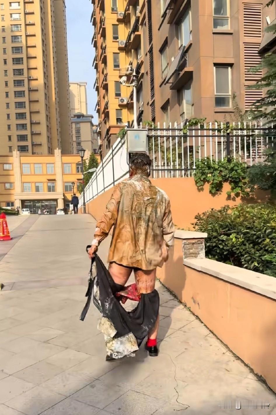 没底线的闹婚把人搞成这样，没感觉很搞笑感觉很无语，血糊淋拉的以为被疝了红袜子是