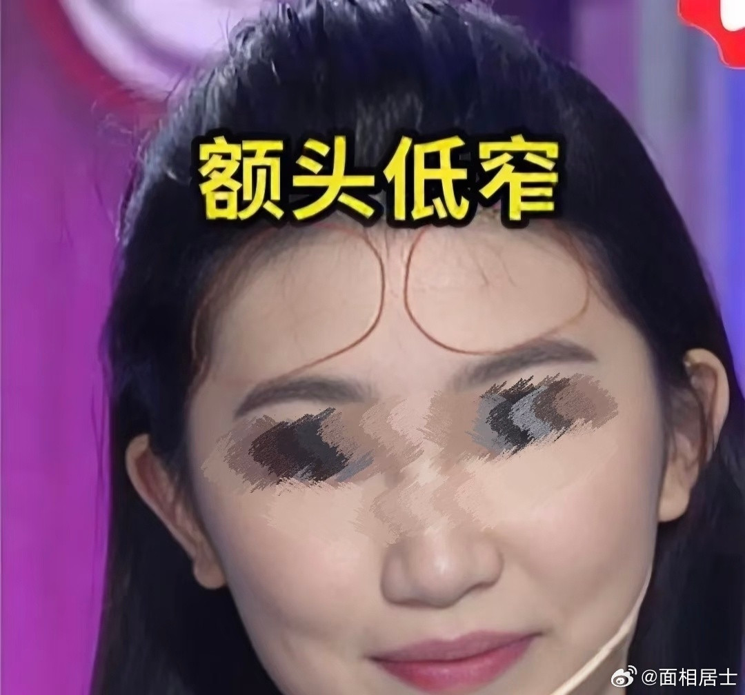 面相学今天讲一种面相特征：发际侵天仓。天仓，就是额头两侧靠近发际线的位置。这种面相，有如下几种情况：