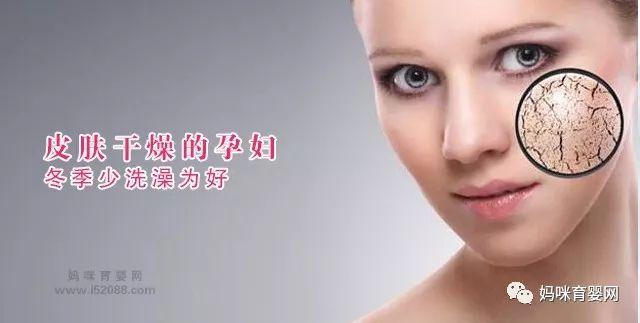 皮肤干燥的孕妇冬季少洗澡为好