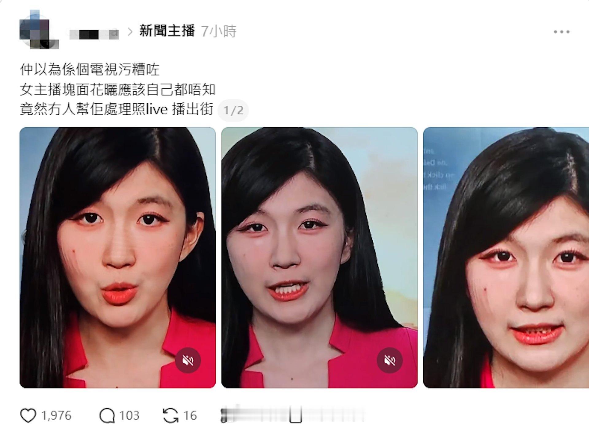 TVB主播贺子欣直播右脸浮现疑似红痕、双眼通红，网友诧异直播许久才补救6月16日
