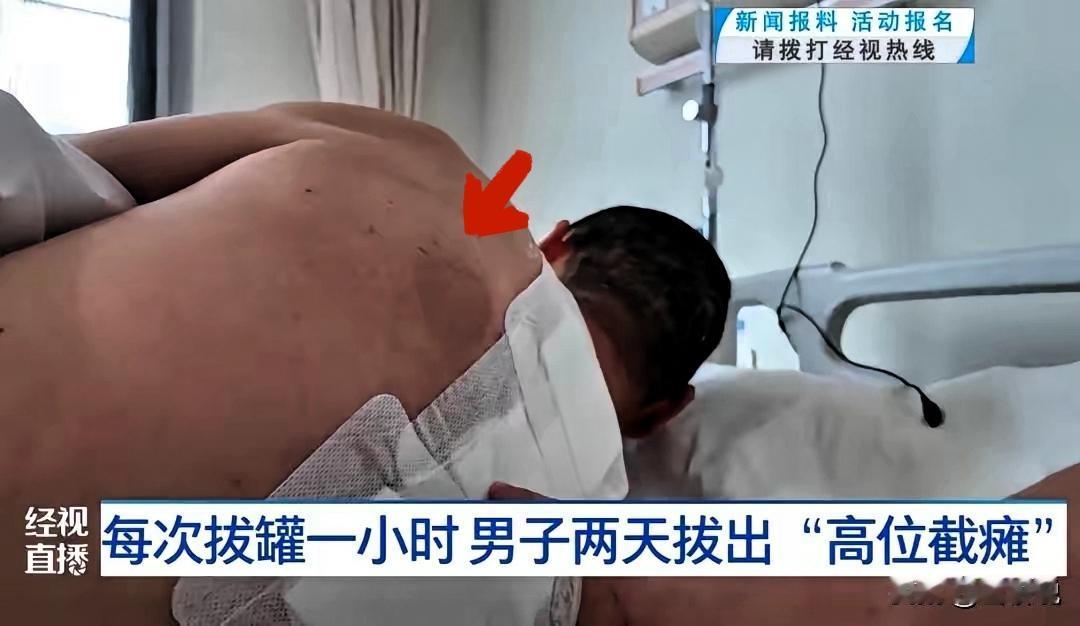 以为是湿气重，拔个火罐竟瘫痪！别再把身体警报当“小毛病”真的要被武汉这位