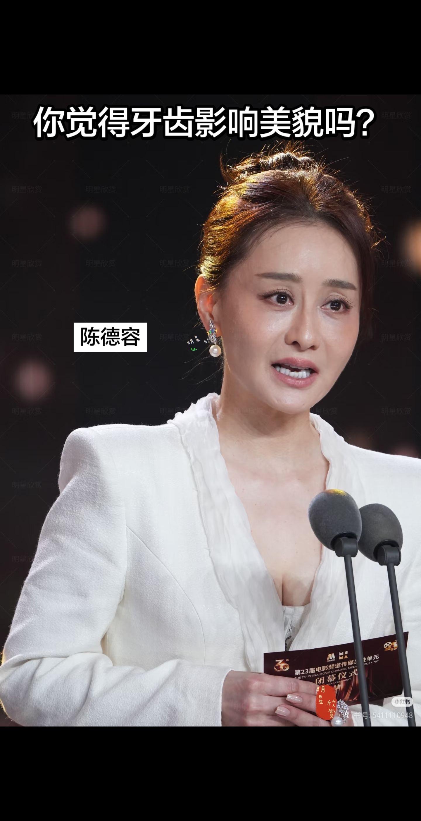 你觉得牙齿影响美貌吗？