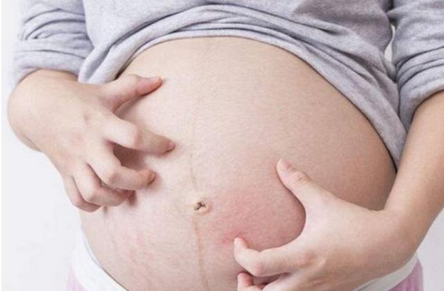 孕妇经常全身发痒, 没想到是发生了这样的事, 知道真相后孕妈痛哭流涕