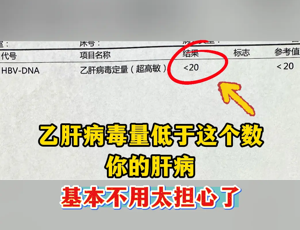 在临床工作中，经常碰见有部分乙肝患者虽然坚持规范的进行抗病毒治疗，常规...