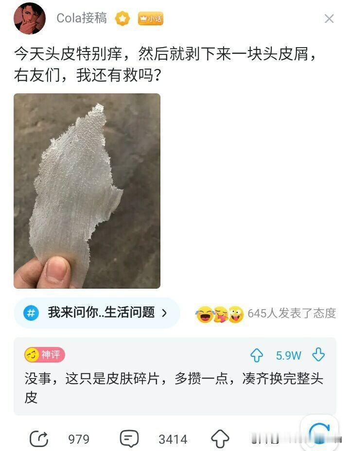 救命！我只是想抠个头皮屑