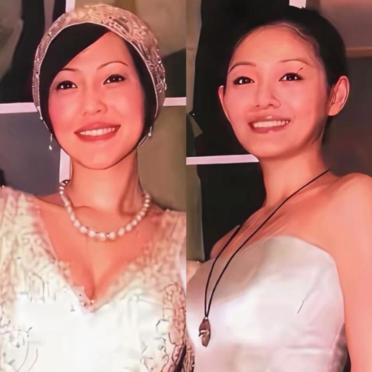 翻看大小S露齿微笑的同框照片，能清晰看出轮廓上的差距：大S人中短、下巴短，脸型偏