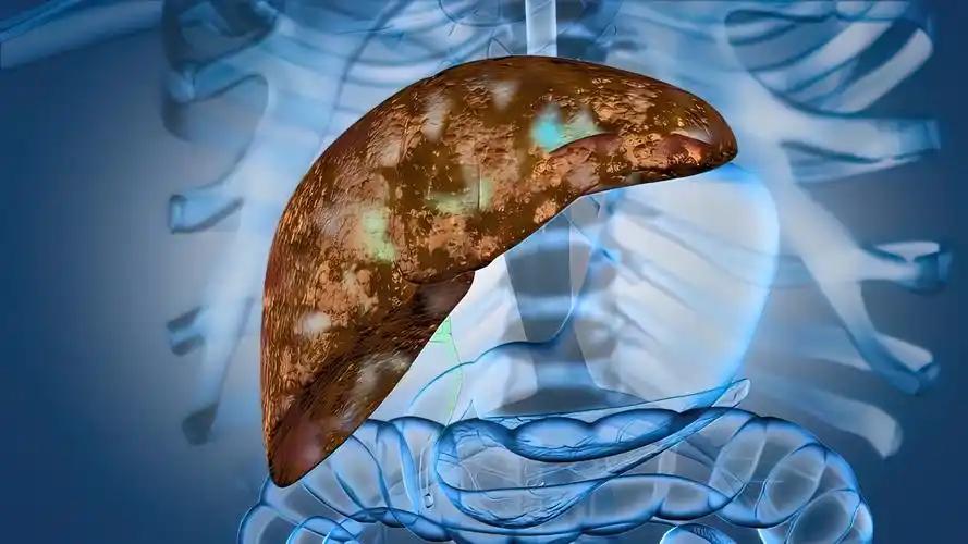 60岁大爷喝酒35年肝脏完好，医生揭露：这3个生活习惯很关键 60岁的张大爷