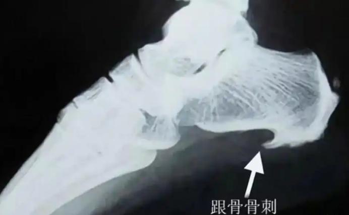 2019年,江苏一名男子因为腰伤脚痛等毛病,向公司多次请病假,公司一开始也同意了