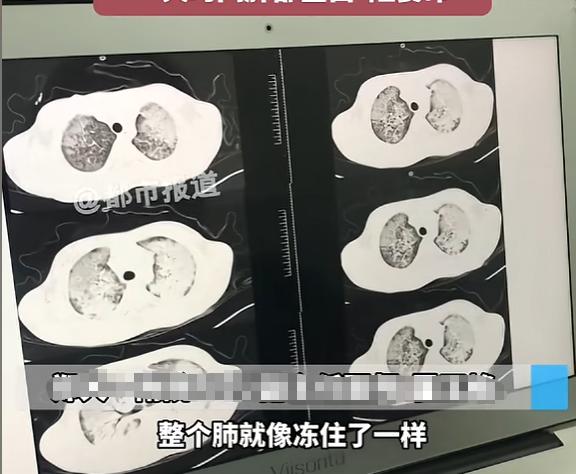 “悲剧还是发生了！”1月22日，河南郑州，一男孩见空气干燥，就把没有清洁的加湿器