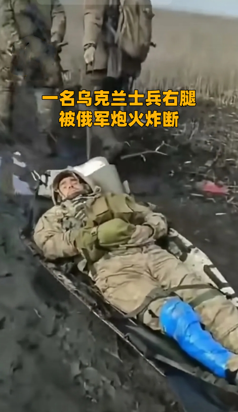 一名乌克兰士兵在库尔斯克地区被俄军炮火炸断右腿，被队友用简易担架拖离前线，送往后