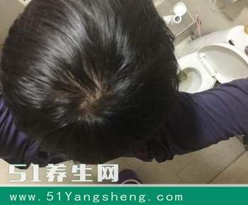 一旋穷, 二旋富, 三旋四旋穿破裤! 头上旋的数量真的会影响孩子吗