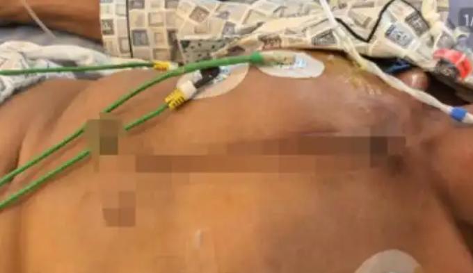 “严查到底！”10月10日，四川泸州，一男子在2楼窗边休息时，突然感觉胸口一阵疼