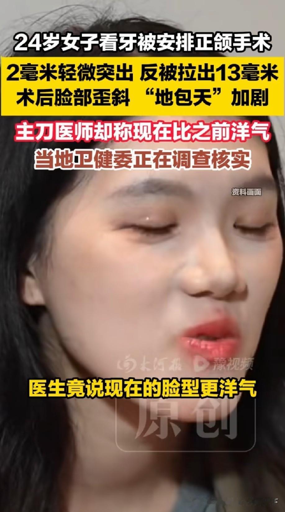有点像朱元璋脸[捂脸哭][捂脸哭]