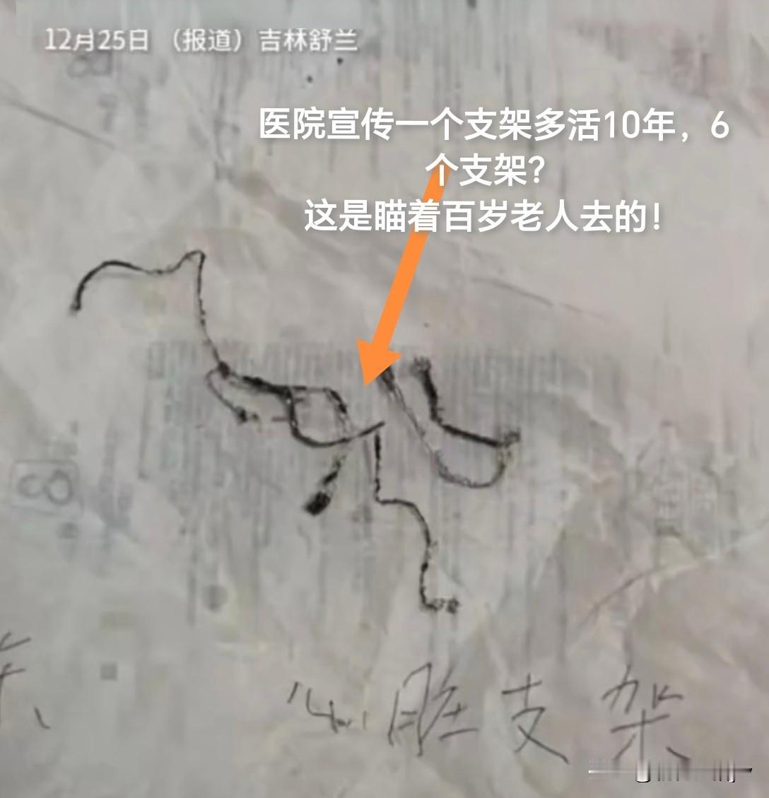 简直震毁三观！男子被一次植入6个支架后去世。其母亲称：是医院害了他，要为