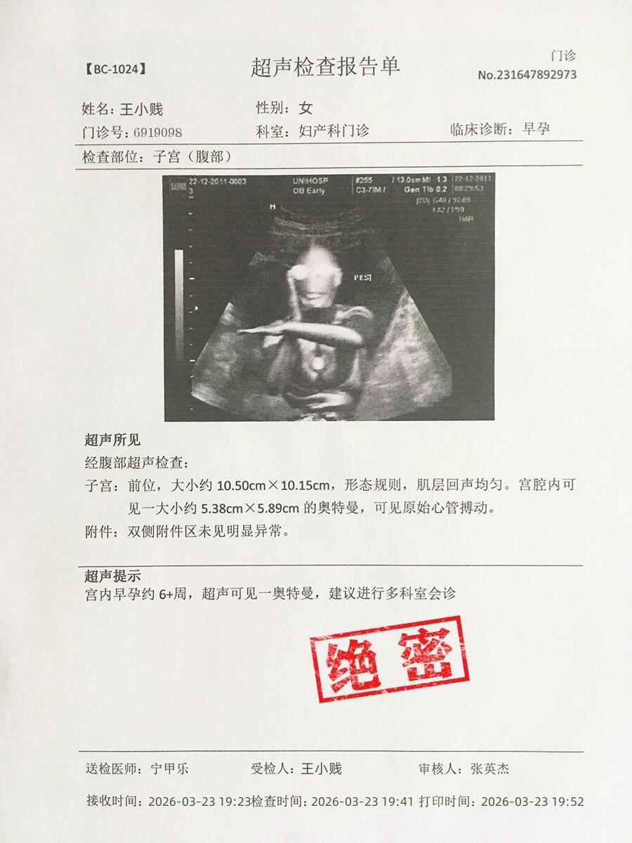 男孩还是女孩呀？谁有经验说说看