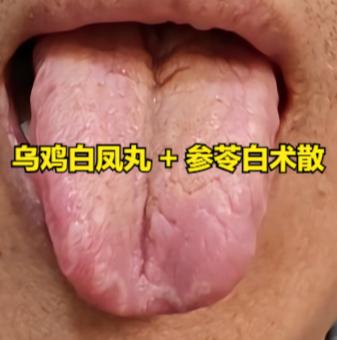 大家好，我是中医陈大夫！很多人脾虚湿气重又想补气血，却怕“补了就堵”——吃点