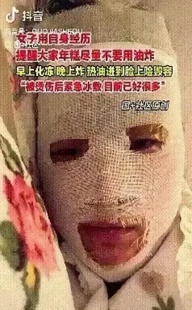 安徽姑娘把没化透的年糕直接丢进热油锅，油花瞬间炸成烟花，脸和手背当场被烫得通红。