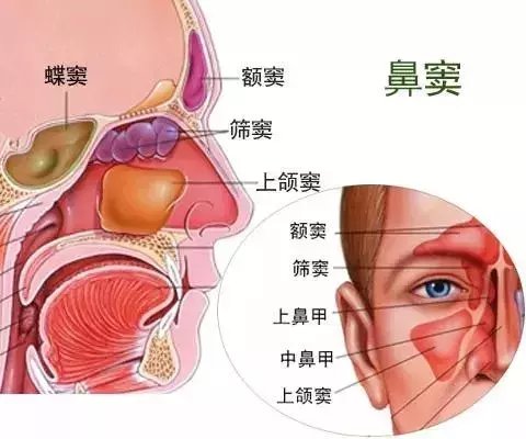 山西惠民耳鼻喉专家: 鼻炎引起鼻窦炎头痛眼痛怎么办呢?