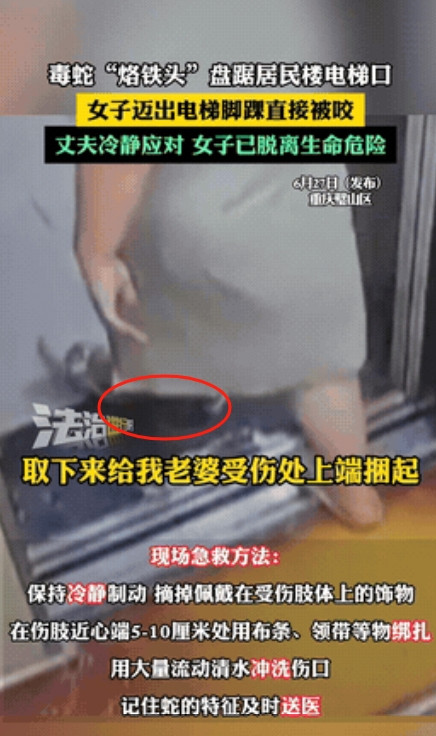 “悲剧还是发生了！”重庆，一女子在小区里出电梯时，突然感到脚上一阵刺痛，她低头看