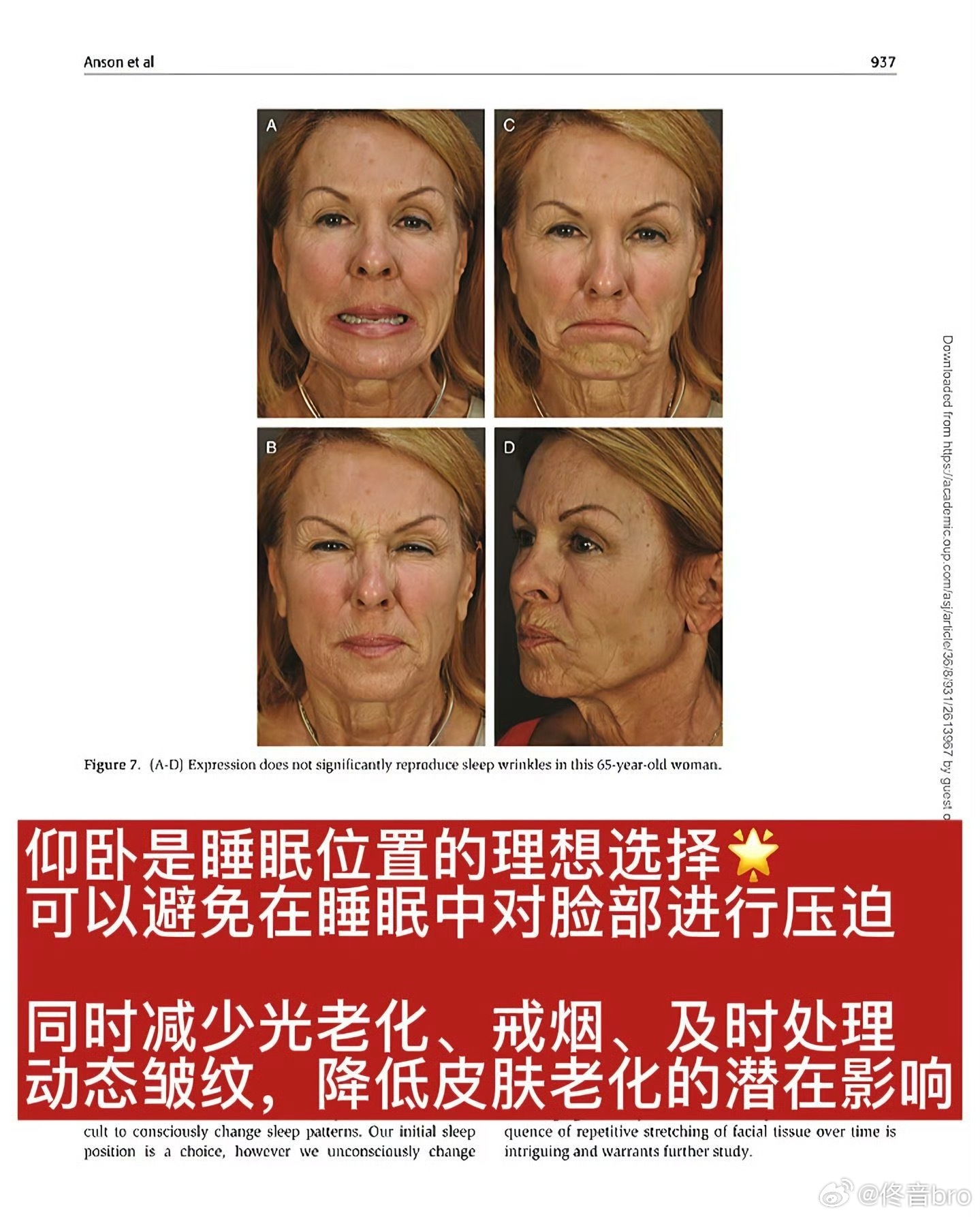 喜欢侧睡的受害者出现了按第一性原理，睡觉的核心是睡得着​​​