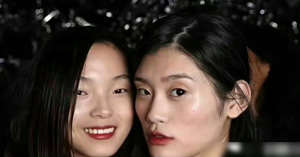 奚梦瑶的脸凹了十年，突然鼓了。不是吃胖，是命变了。当年混维密，两颊凹得能装鸡蛋，那叫高级脸，说白了就