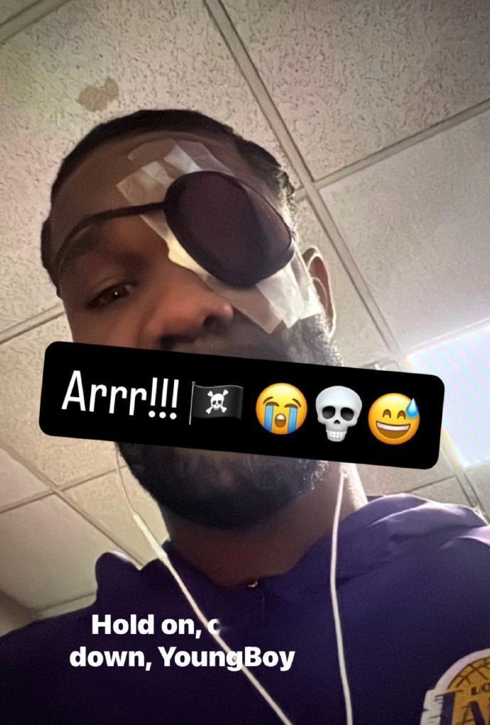 艾顿赛后这造型，真的成海盗了~[捂脸哭]雷迪克在赛后坦言，艾顿的眼睛戴上眼罩后