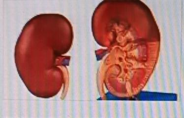 肾透析后的生存期受多种因素影响。患者整体健康状况很关键，若没有心脏病、糖尿病等严