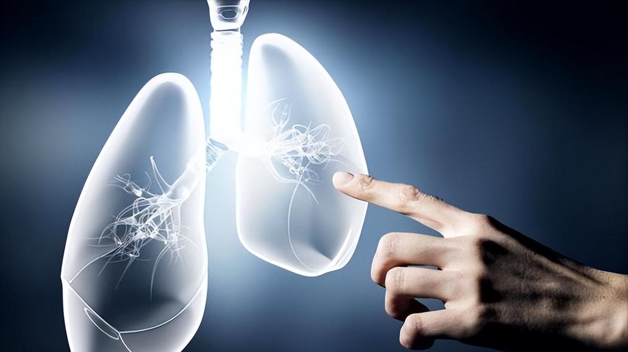 得了慢阻肺（COPD），还能活多久？医生给你一个客观答案“查出慢阻肺，是不是就
