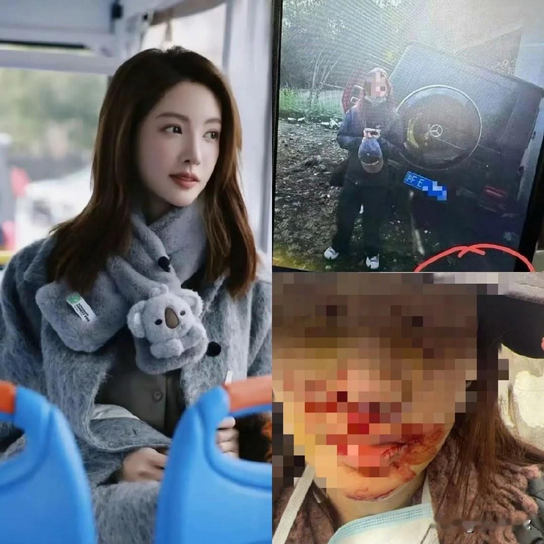 金晨在证明自己受伤的时候，选择了晒打了马赛克的自拍图，而不是医院单据。这个肯定是