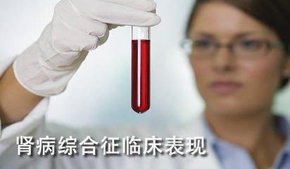 肾衰竭、尿毒症必须要做的4项检查, 看看自己做对了没有?