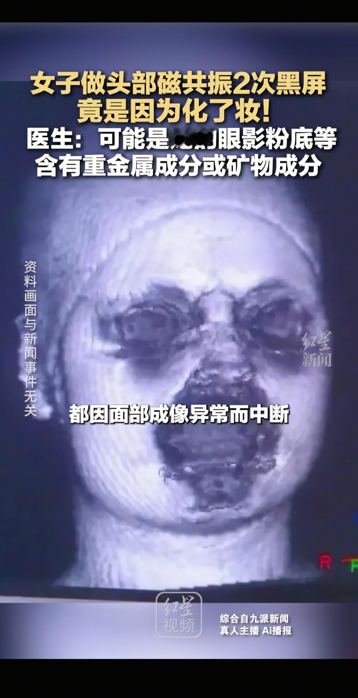 差点解释不清了，福建泉州，一女子头晕去医院检查，没想到，做核磁共振时先后两次出现