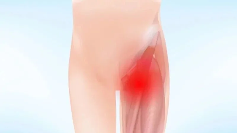 股沟，才是人体“被忽视的发动机”