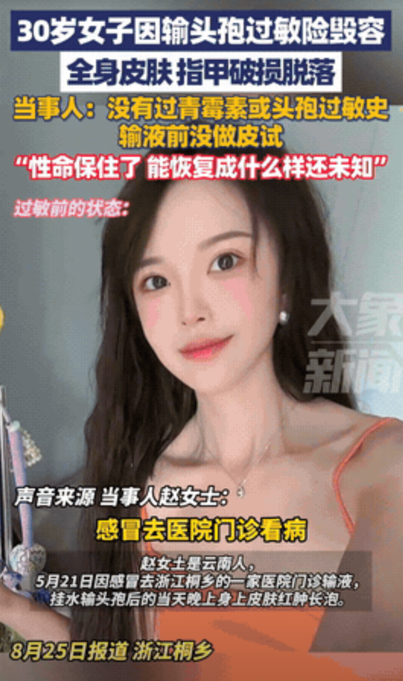 “太可怕了！”浙江杭州，一30岁女子感冒去医院输液，没想到输液后不久，女子就出现