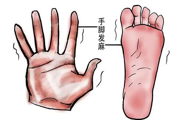 手脚发麻别忽视！两味中药帮你通经络、散瘀堵总感觉手脚发麻、没知觉？别不当回