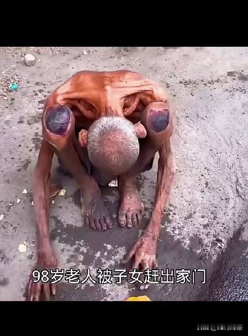 98岁老人被儿女赶出家门，只能靠乞讨和捡拾垃圾活命，浑身上下几乎没穿啥衣服，整个