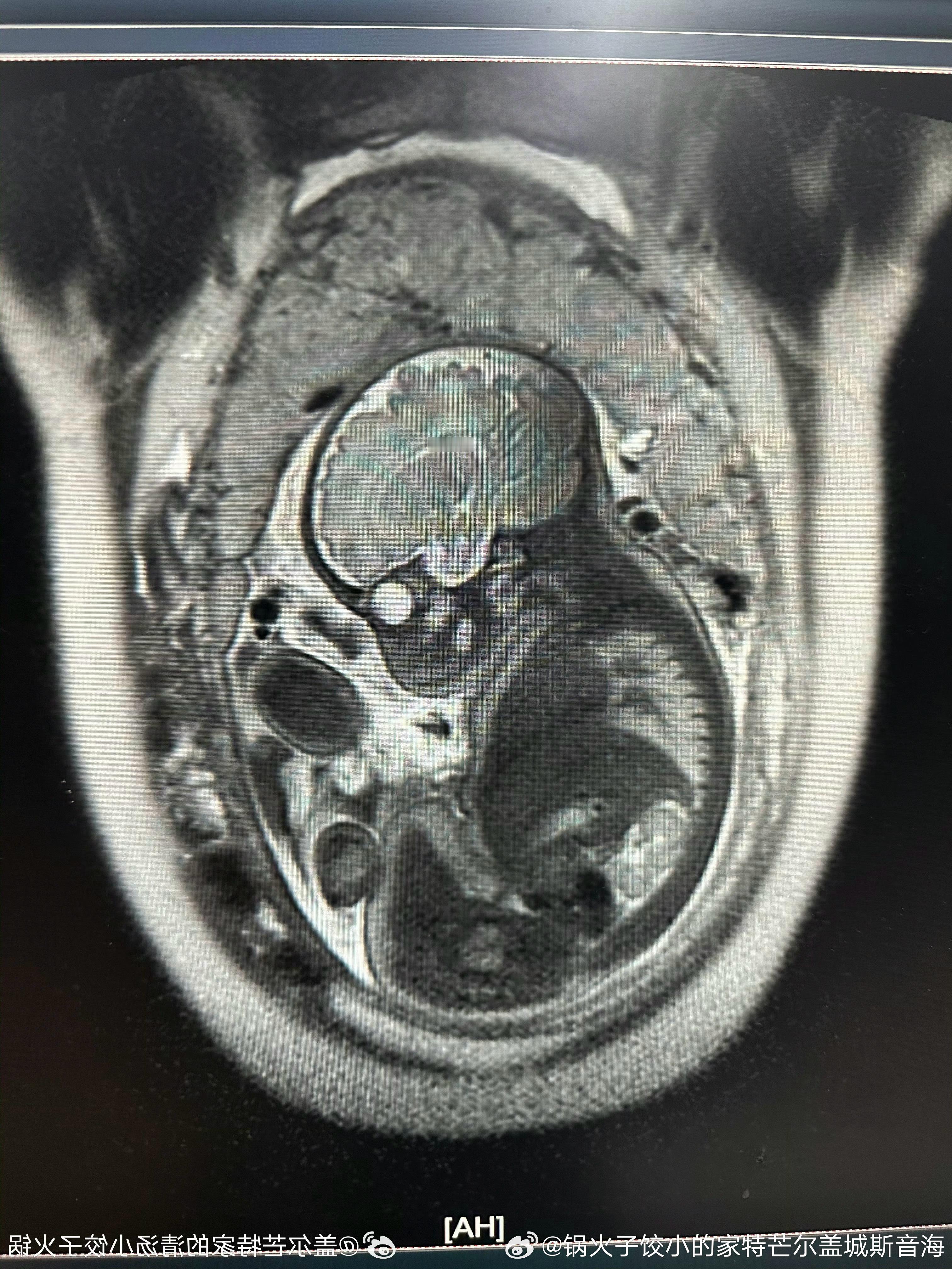 10：3102˙21˙3202儿孩男小个是还！爱可多，宝宝小的下磁核