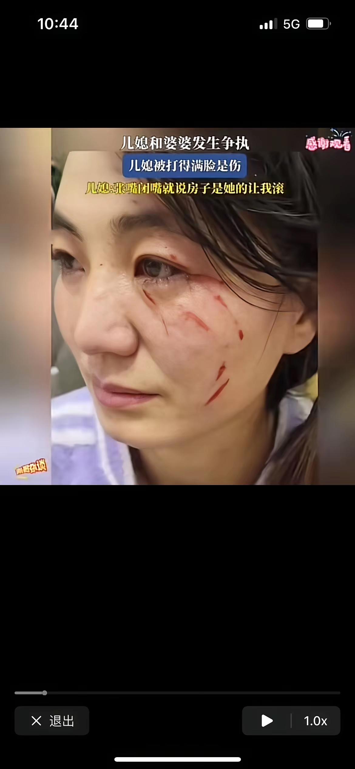 一儿媳和婆婆发生争执，激动之下竟然动了手，儿媳被婆婆抓的满脸都是伤，特别是眼角那